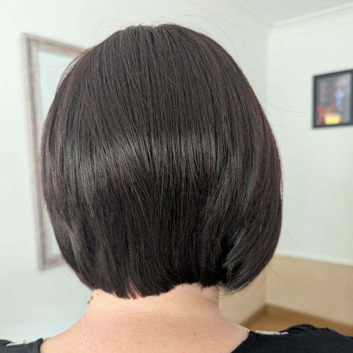 back of patients head showing wig that has been provided