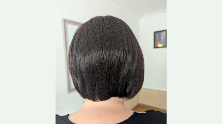 back of patients head showing wig that has been provided